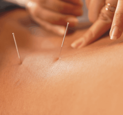 Unlocking Your Body's Natural Healing Power with Acupuncture